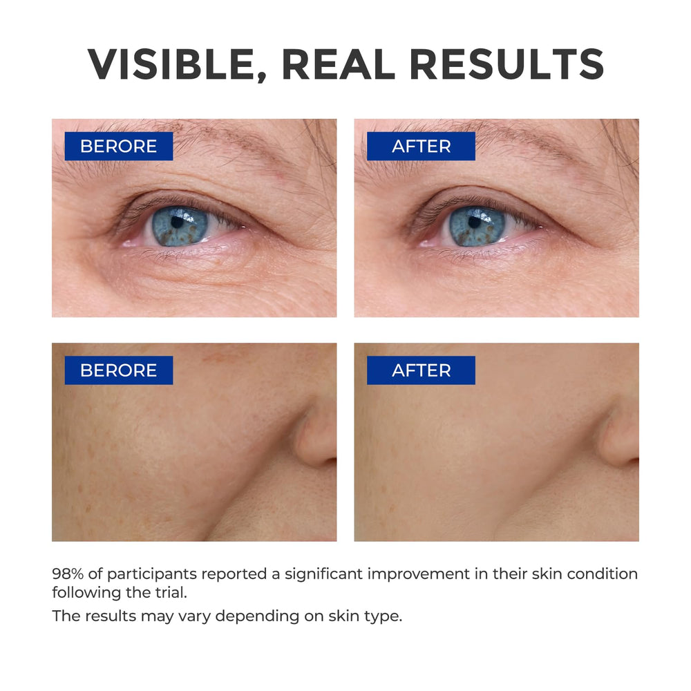 SKINERSE serum texture applied to skin demonstrates lightweight, non-greasy finish.