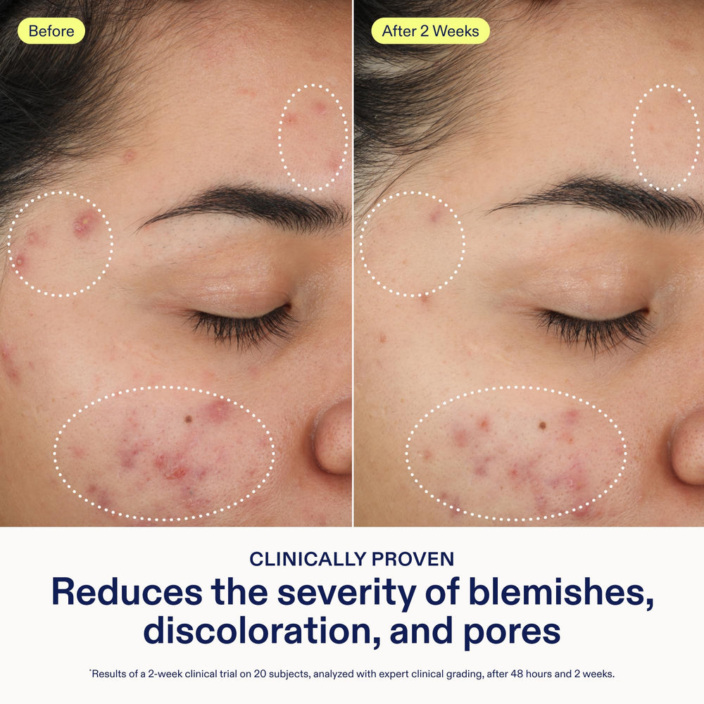 Skinfix 2% BHA Cleanser with green tea and zinc—soothing inflammation for clearer skin.