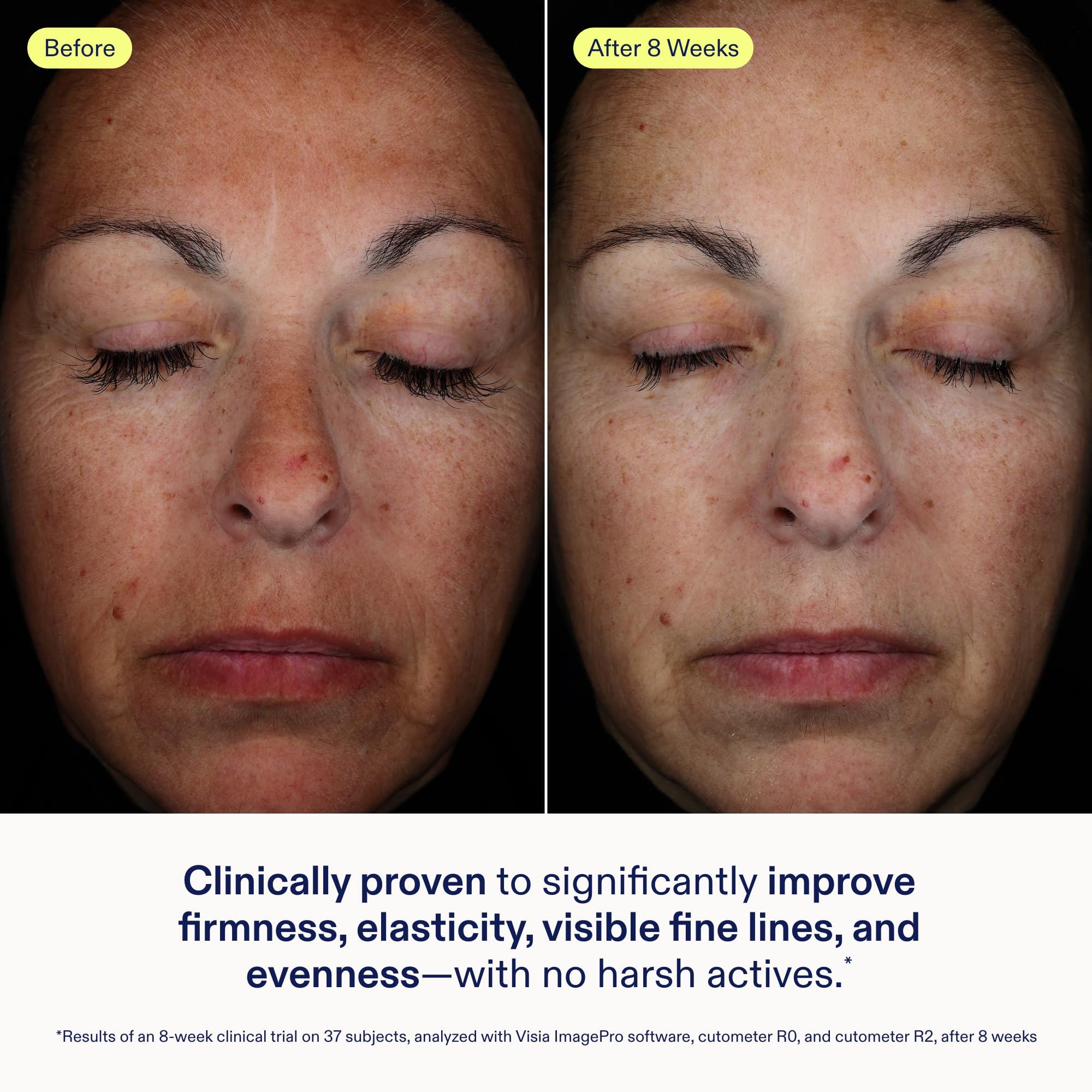 Skinfix Exo + Ectoin baume jar close-up reveals silky texture for sensitive skin.