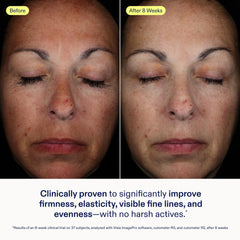 Skinfix Exo + Ectoin baume jar close-up reveals silky texture for sensitive skin.
