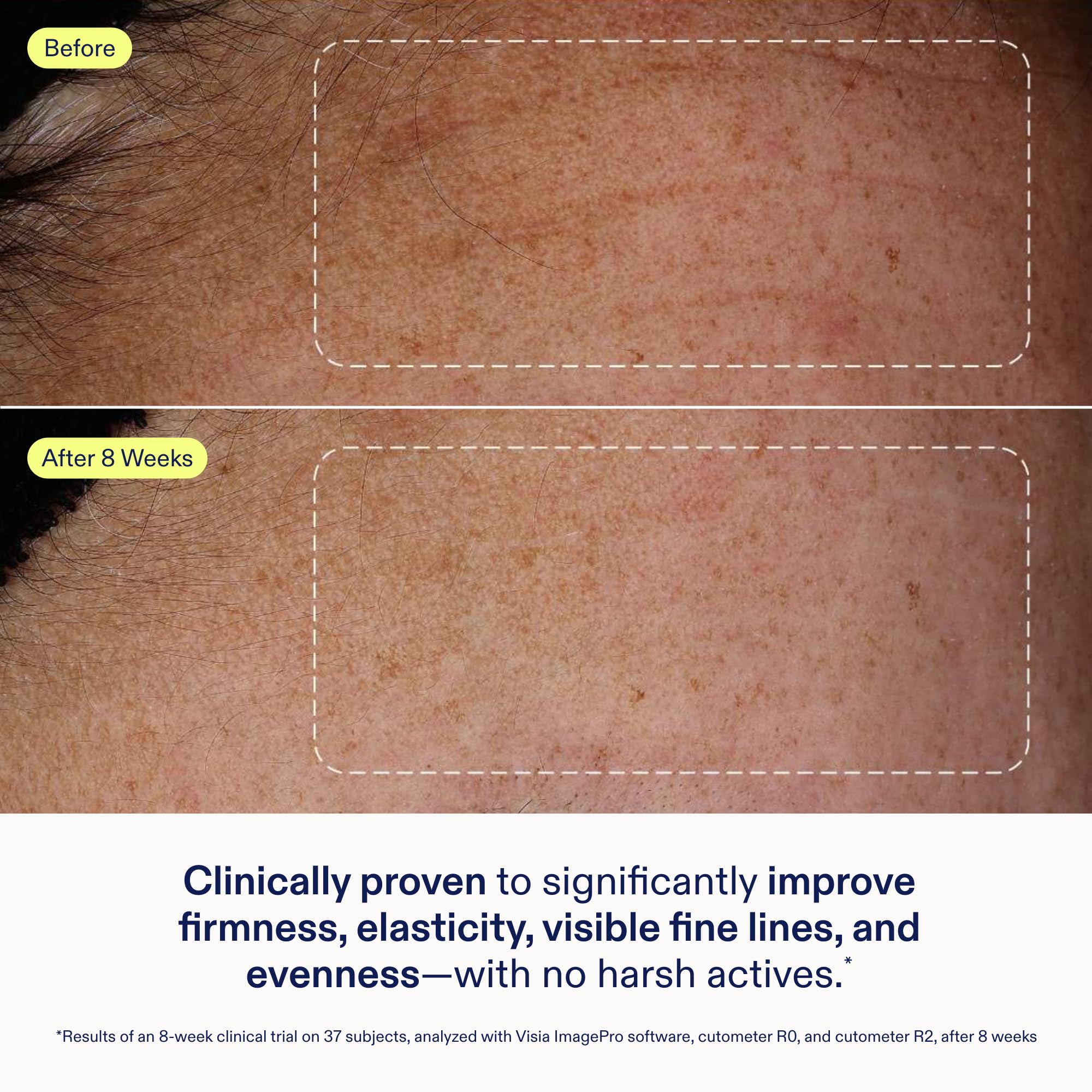 Skinfix Exo + Ectoin fragrance-free label signals fragrance-free, sensitive-skin friendly.