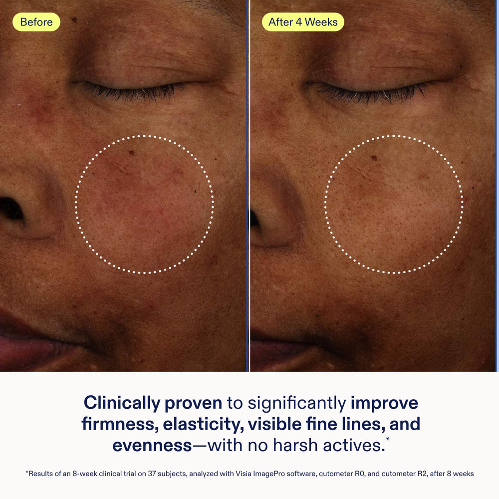 Skinfix Exo + Ectoin ingredients panel shows growth-factor peptides for elasticity.