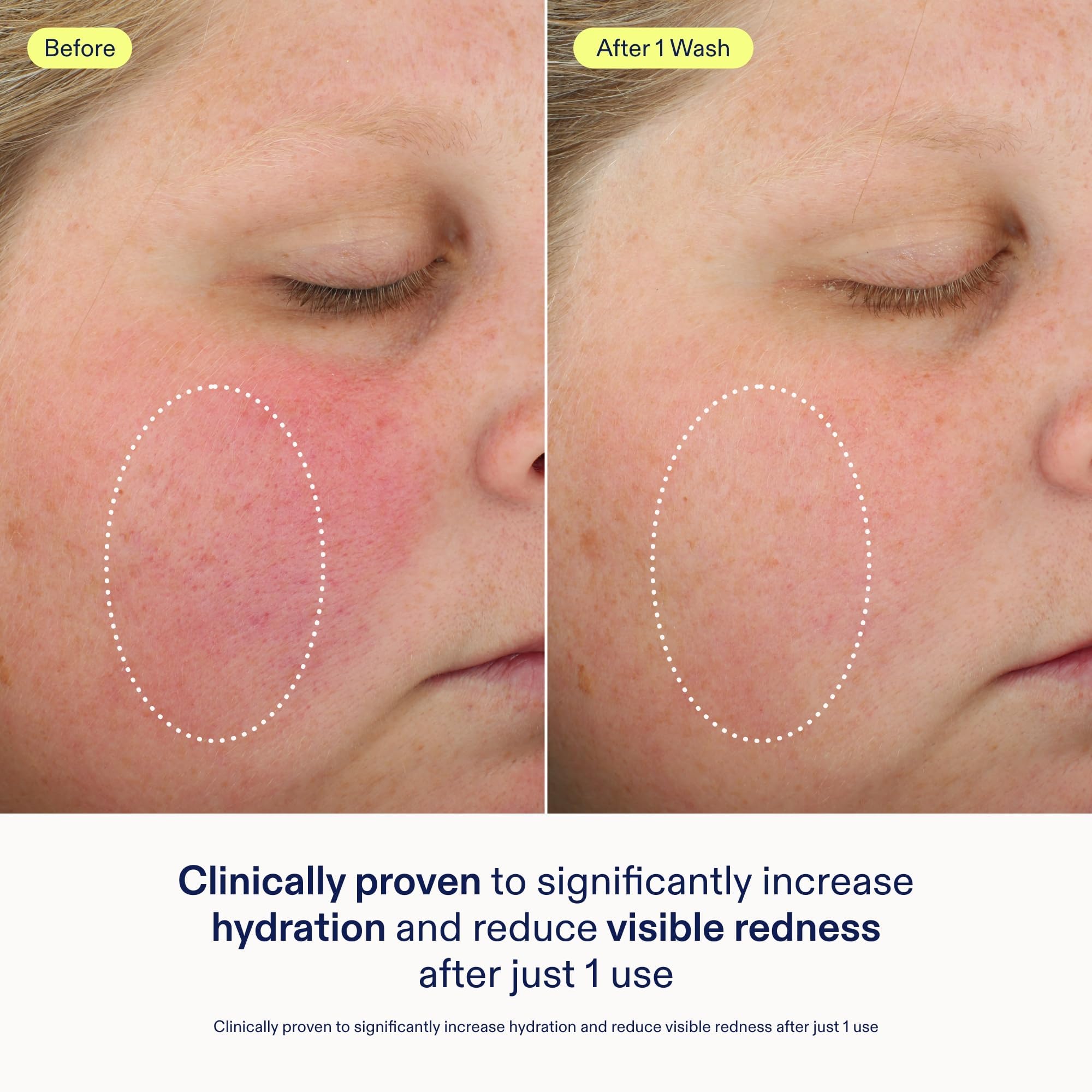 Skinfix foaming oil cleanser gel-to-foam texture captured mid-transition.