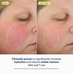 Skinfix foaming oil cleanser gel-to-foam texture captured mid-transition.
