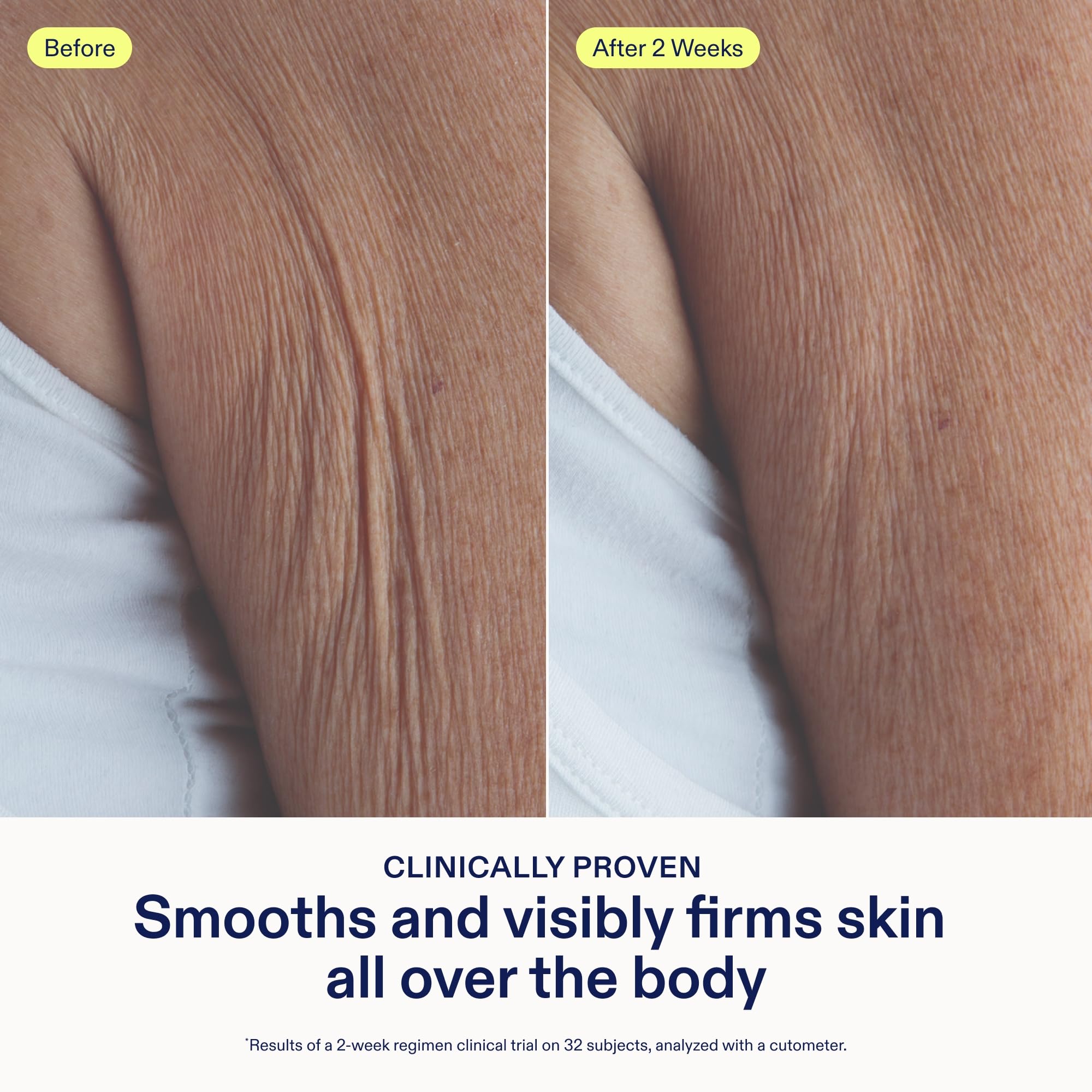Skinfix Glycolic Renewing Scrub texture close-up shows bamboo scrubbers lifting flaky patches