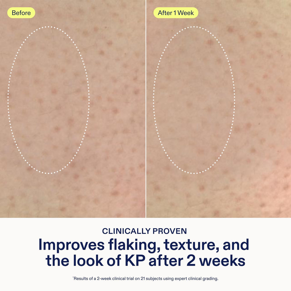 Skinfix smoothing cream emollients squalane and glycerin showcase deep hydration.