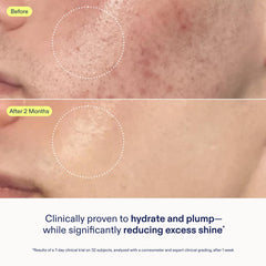 Skinfix Skin Barrier Gel Cream morning routine image shows light hydration.