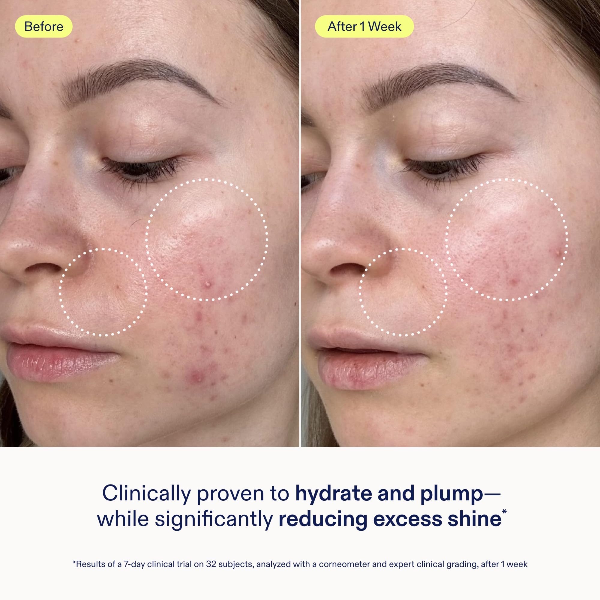 Skinfix Skin Barrier Gel Cream night routine scene suggests overnight barrier support.