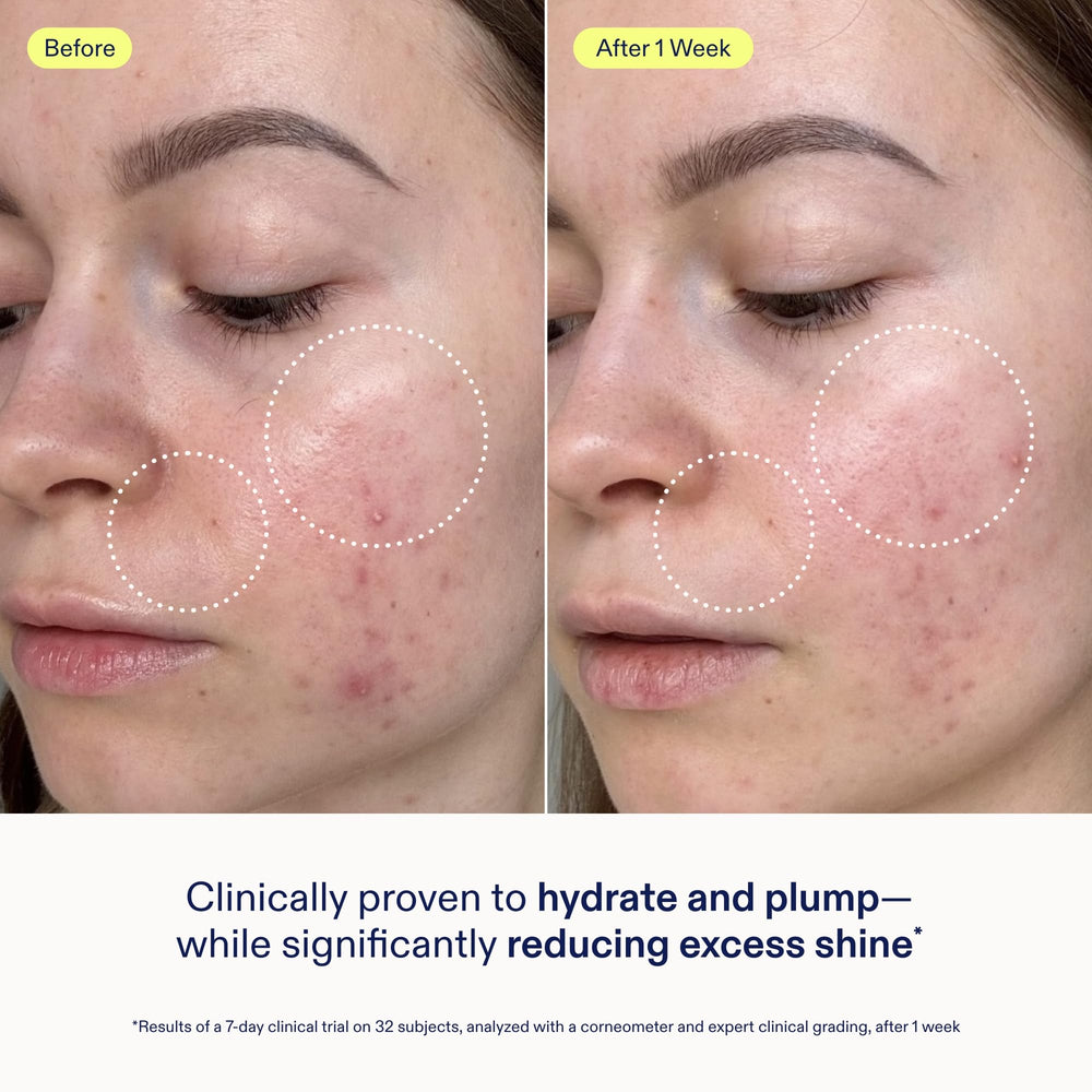 Skinfix Skin Barrier Gel Cream night routine scene suggests overnight barrier support.