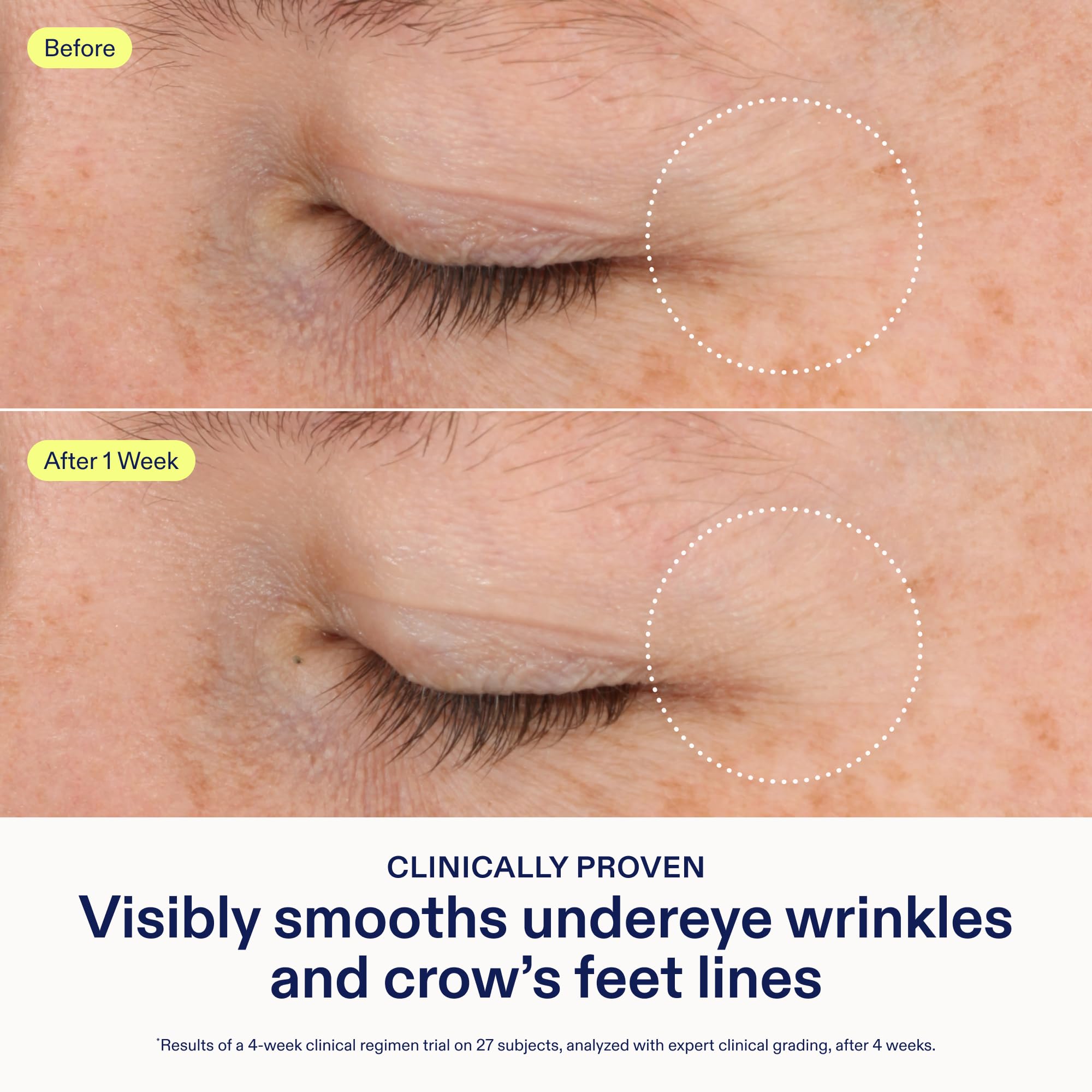 Skinfix Triple Lipid-Boost 360 Eye texture closeup highlights plush creamy formula for under-eye care.