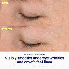 Skinfix Triple Lipid-Boost 360 Eye texture closeup highlights plush creamy formula for under-eye care.