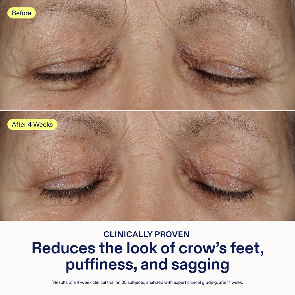 Skinfix texture-gel close-up demonstrates fast absorption for smooth under-eye prep.