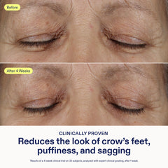 Skinfix texture-gel close-up demonstrates fast absorption for smooth under-eye prep.