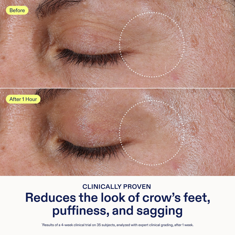 Skinfix Triple Lipid Eye Treatment tube cap close-up highlighting fragrance-free formula.