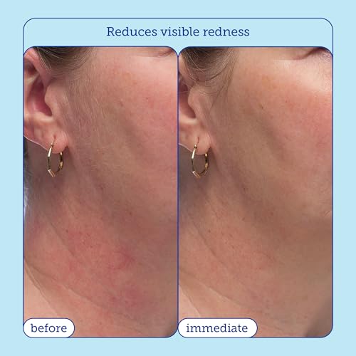 Skinfix Triple Lipid-Peptide Cream ceramides close-up highlighting moisture barrier support.