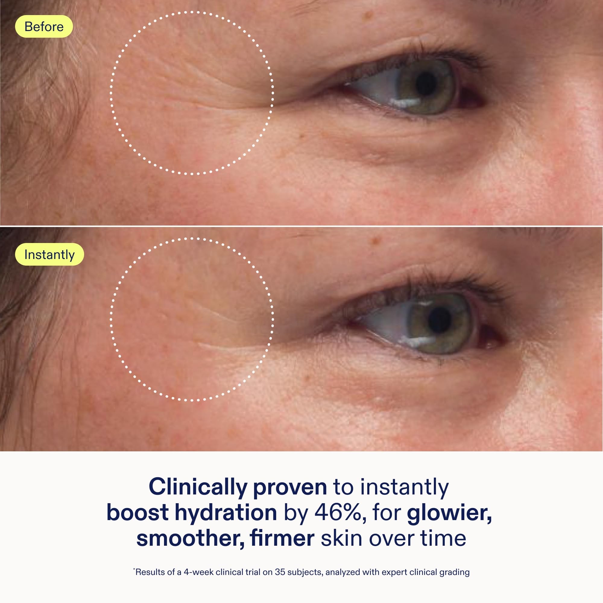 Skinfix cream with hyaluronic acid provides instant moisture and long-lasting plumpness