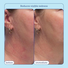Texture swirl of Skinfix cream reveals creamy, non-greasy finish suitable for sensitive skin