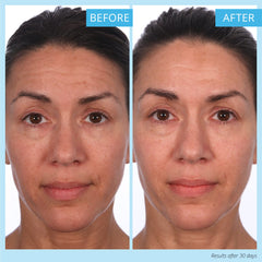 SKINN Crème Reverse hyaluronic sphere texture demonstrates instant wrinkle filling and hydration