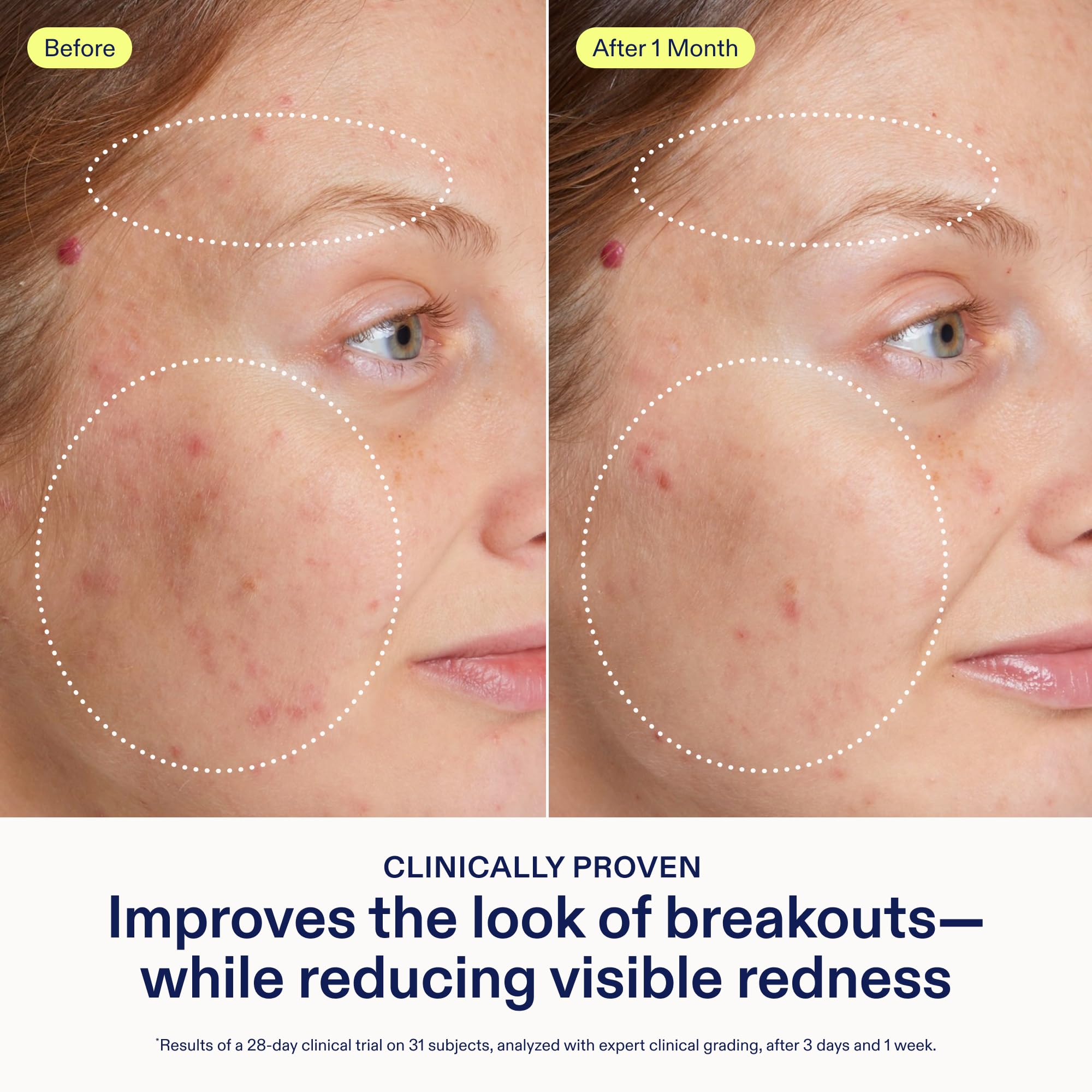 Ingredients Niacinamide visual highlights pores-minimizing and even-toning potential.