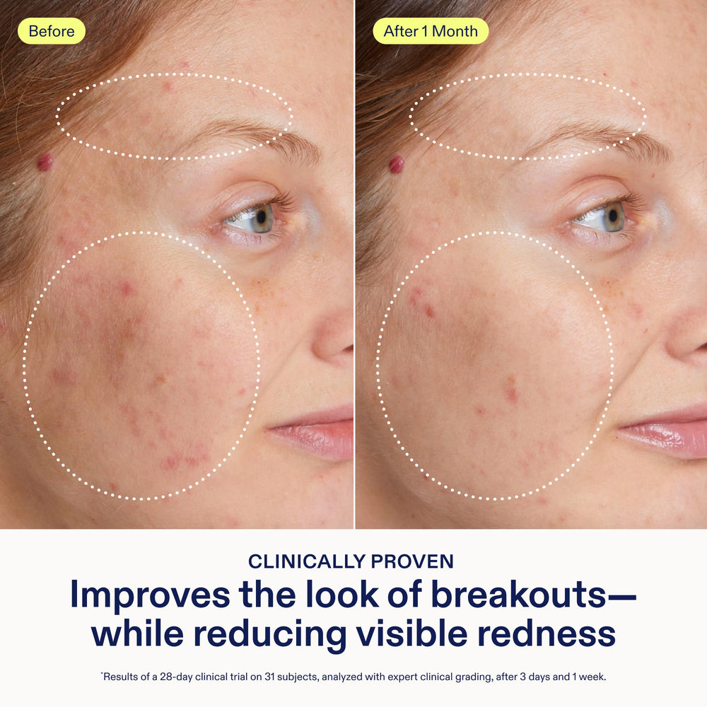 Ingredients Niacinamide visual highlights pores-minimizing and even-toning potential.