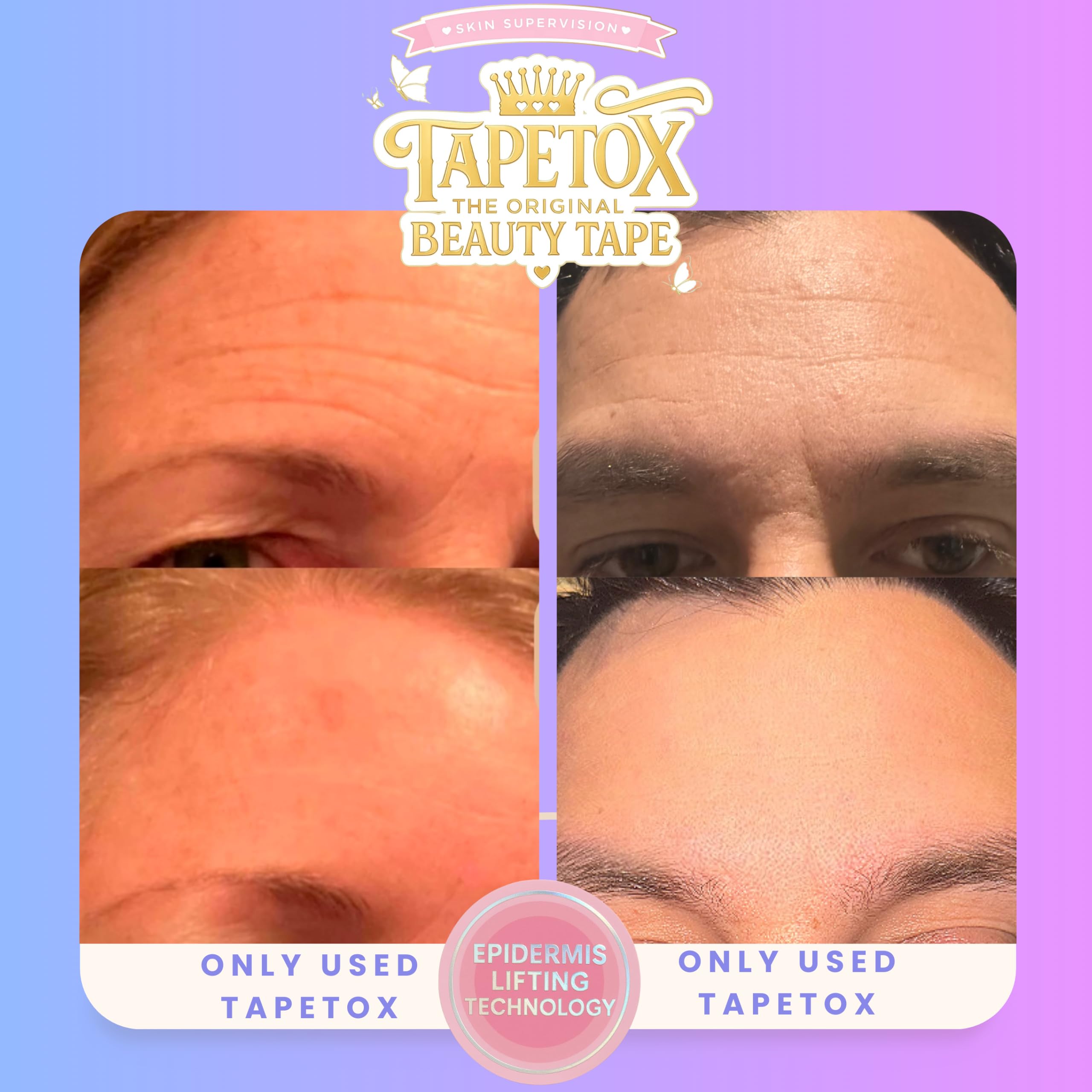 Skin Supervision TapeTox glow after use hints waking skin feeling soft and smooth.