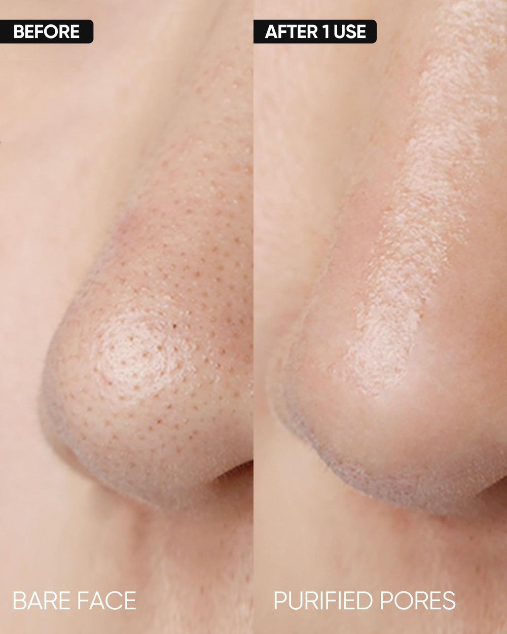 SKINTIFIC Deep Pore Cleansing Stick applying on skin for targeted pore cleansing.