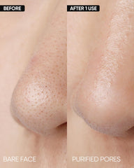 SKINTIFIC Deep Pore Cleansing Stick applying on skin for targeted pore cleansing.