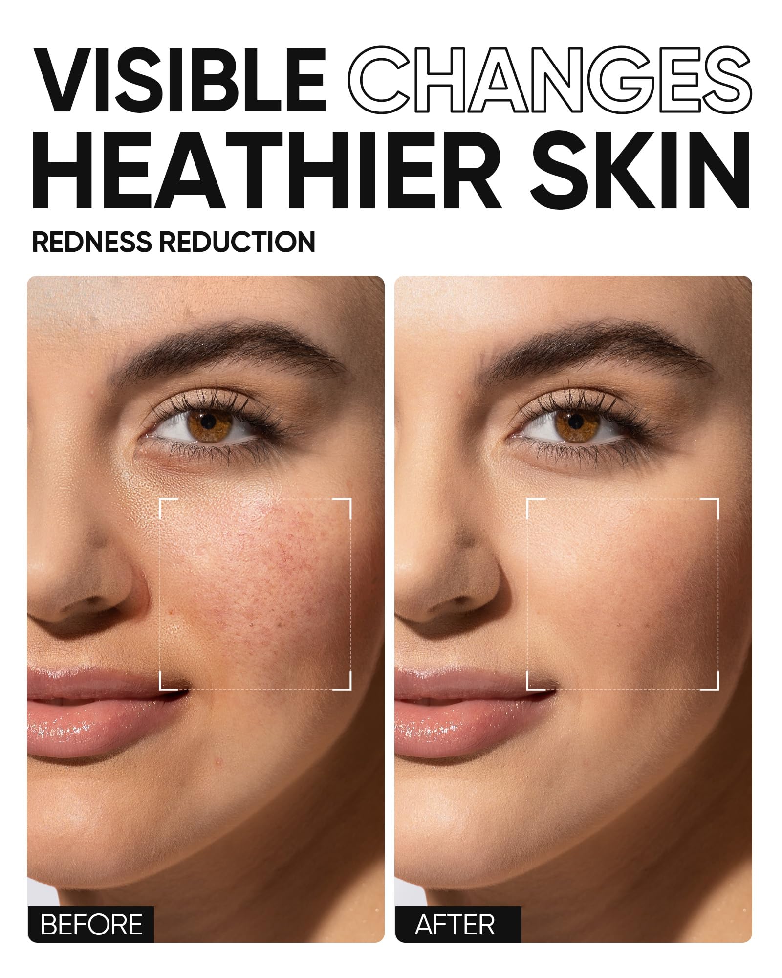 SKINTIFIC non-comedogenic badge implies suitability for acne-prone skin.