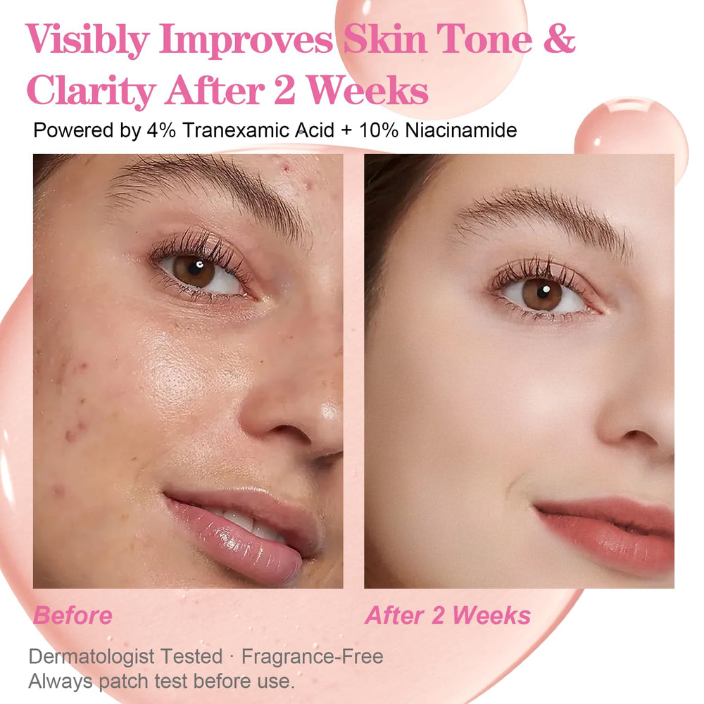 SKSOYT Arbutin 2% serum dropper targets stubborn spots for more even skin.