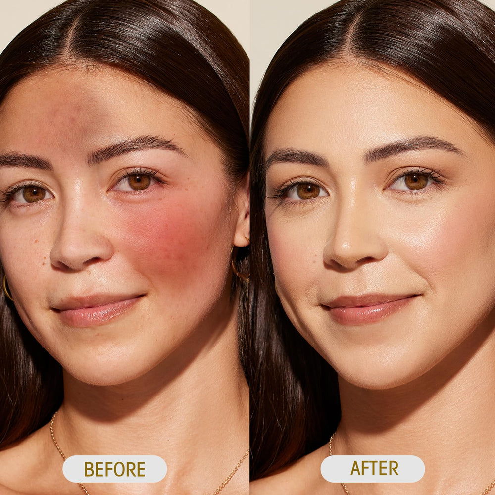 SKSOYT paracress oil application on skin for daily use