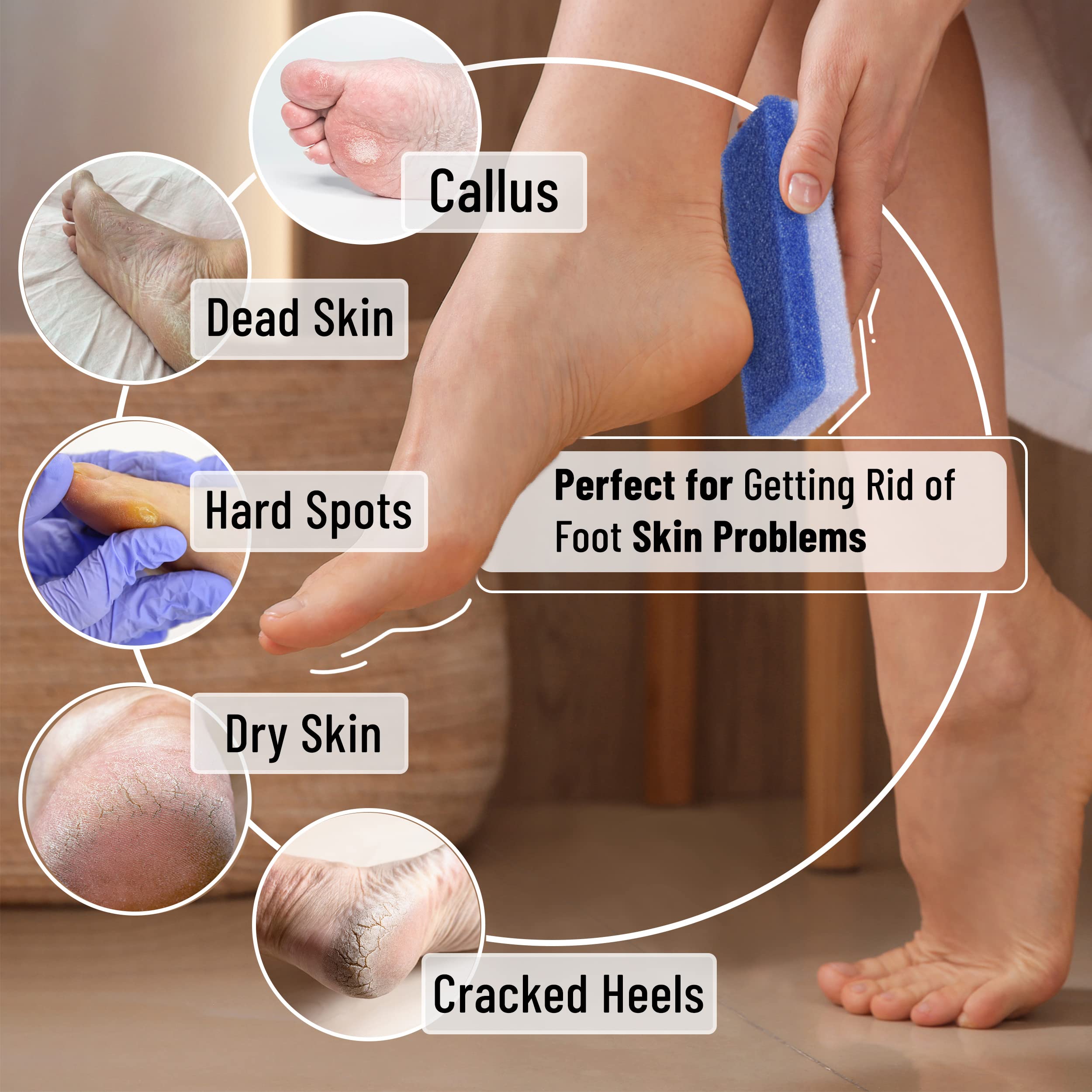 Slick Solutions pumice stone dead-skin removal closeup demonstrates effective exfoliation