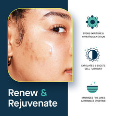 SLMD Resurfacing Retinol Serum night-application scene suggests quick-absorbing gel texture