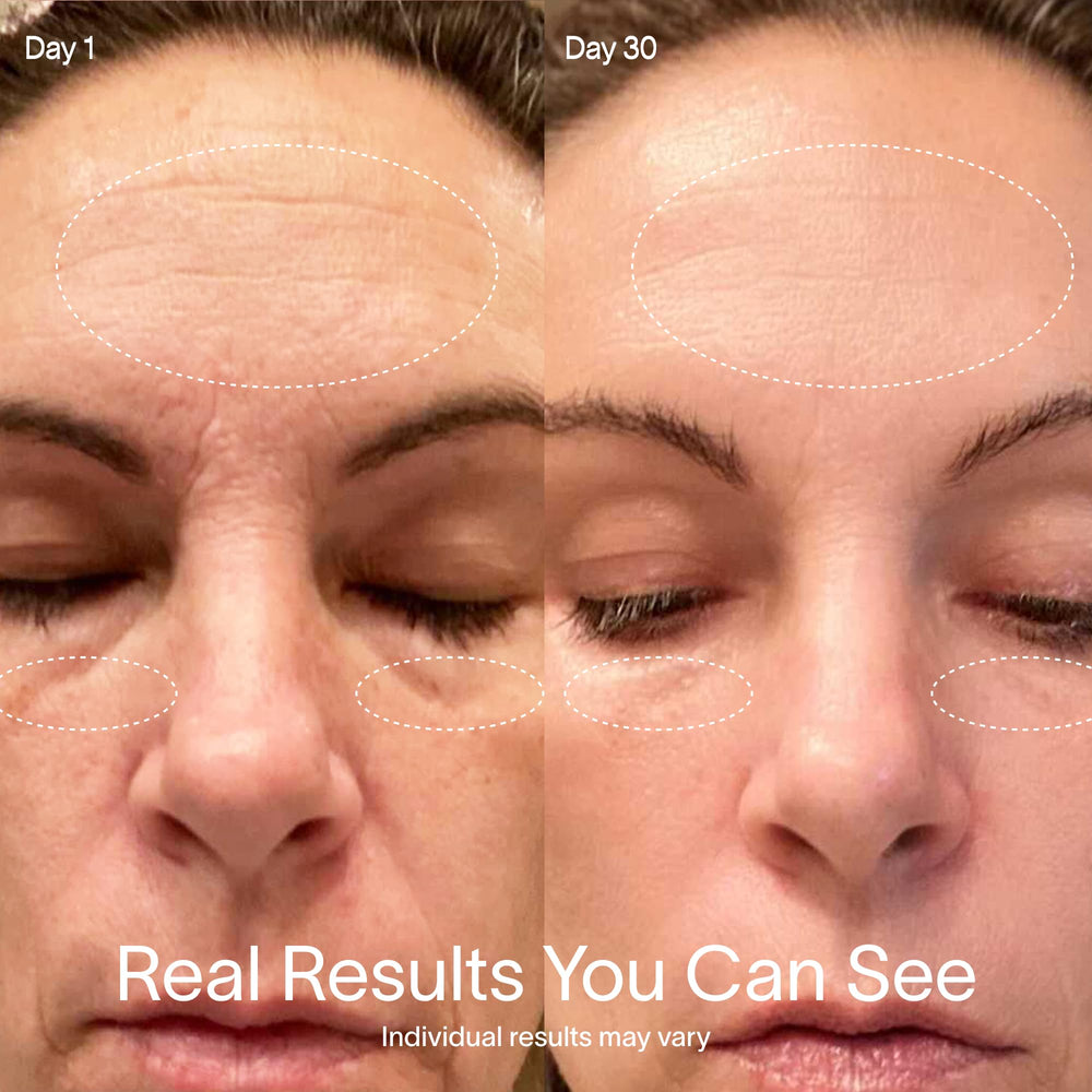 Solawave wand on cheeks enhances glow and radiance.
