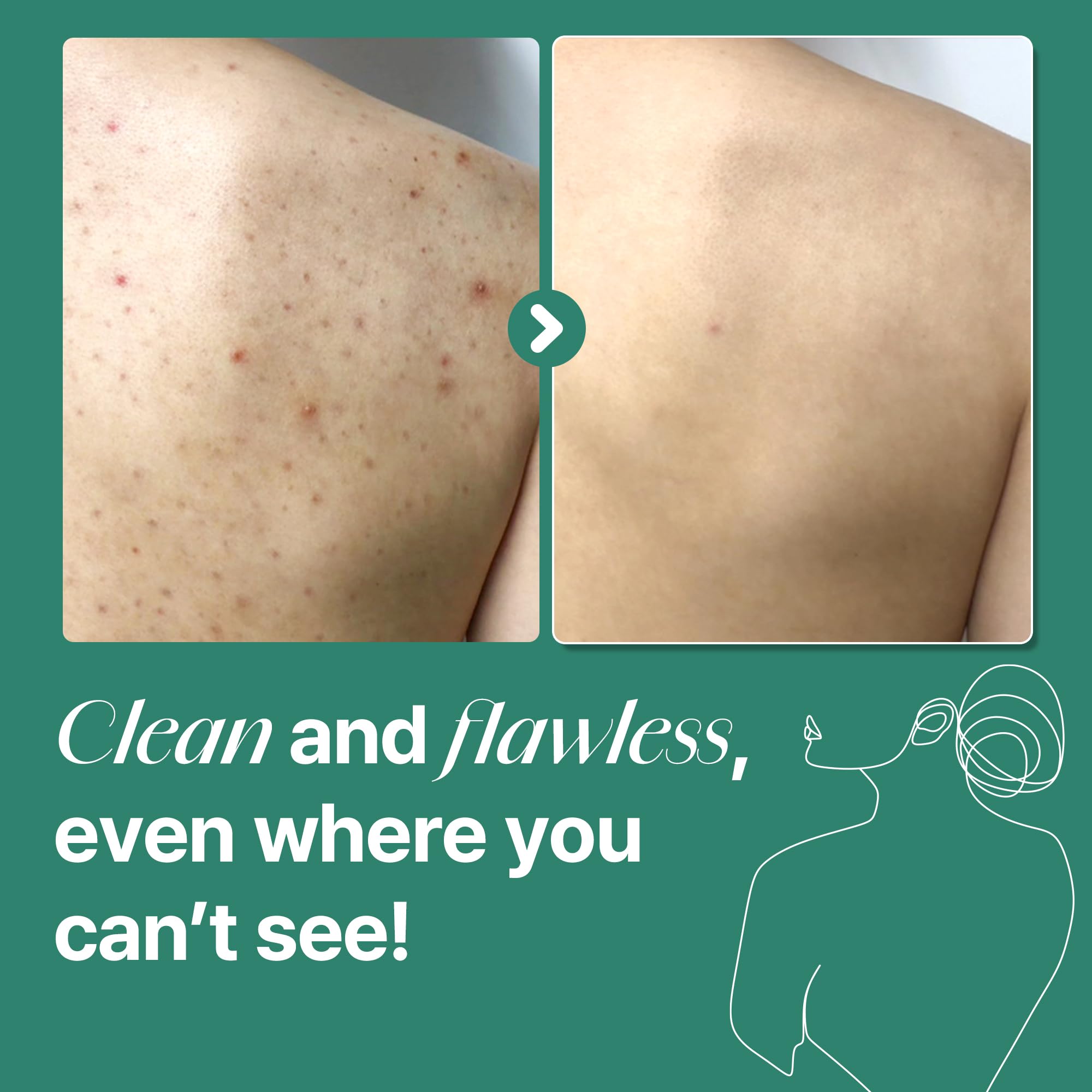 SOME BY MI micro-bubbles technology graphic shows deep cleansing of impurities