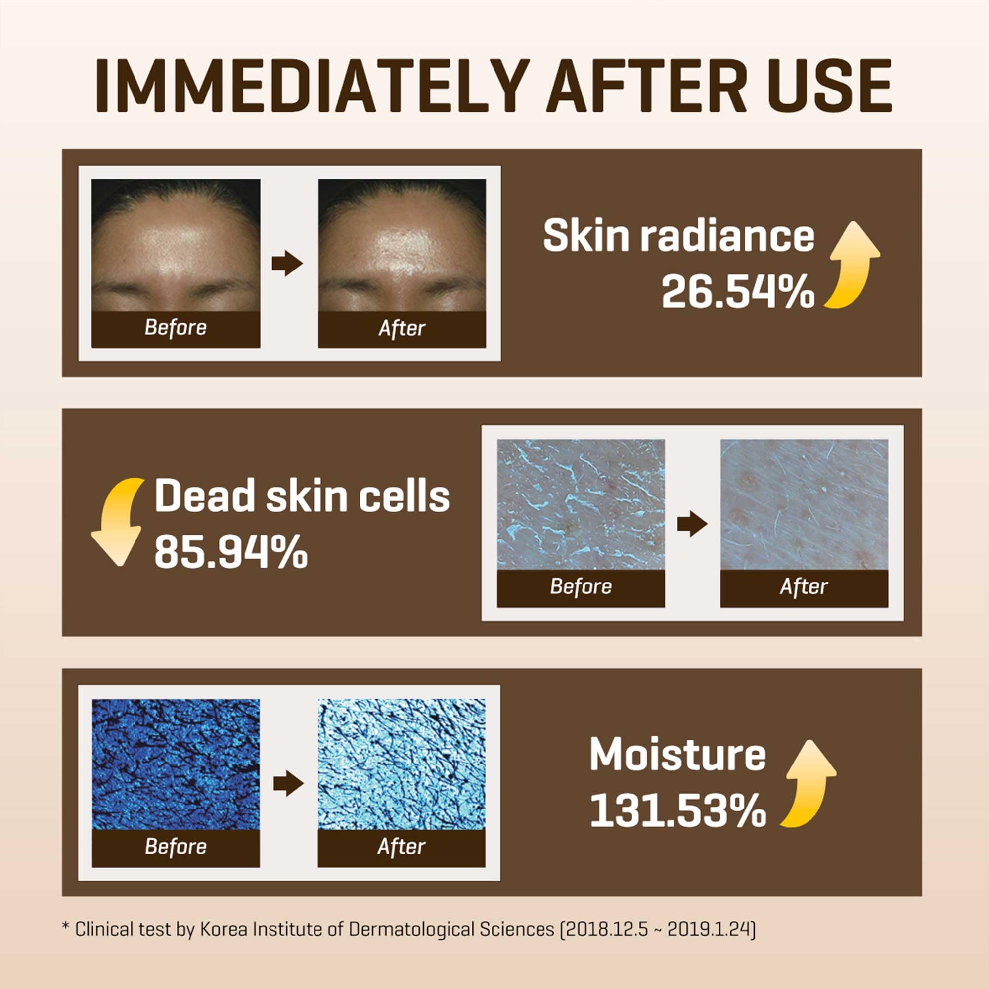 SOME BY MI Galactomyces Vitamin C Toner glass bottle signals premium, clean skincare.