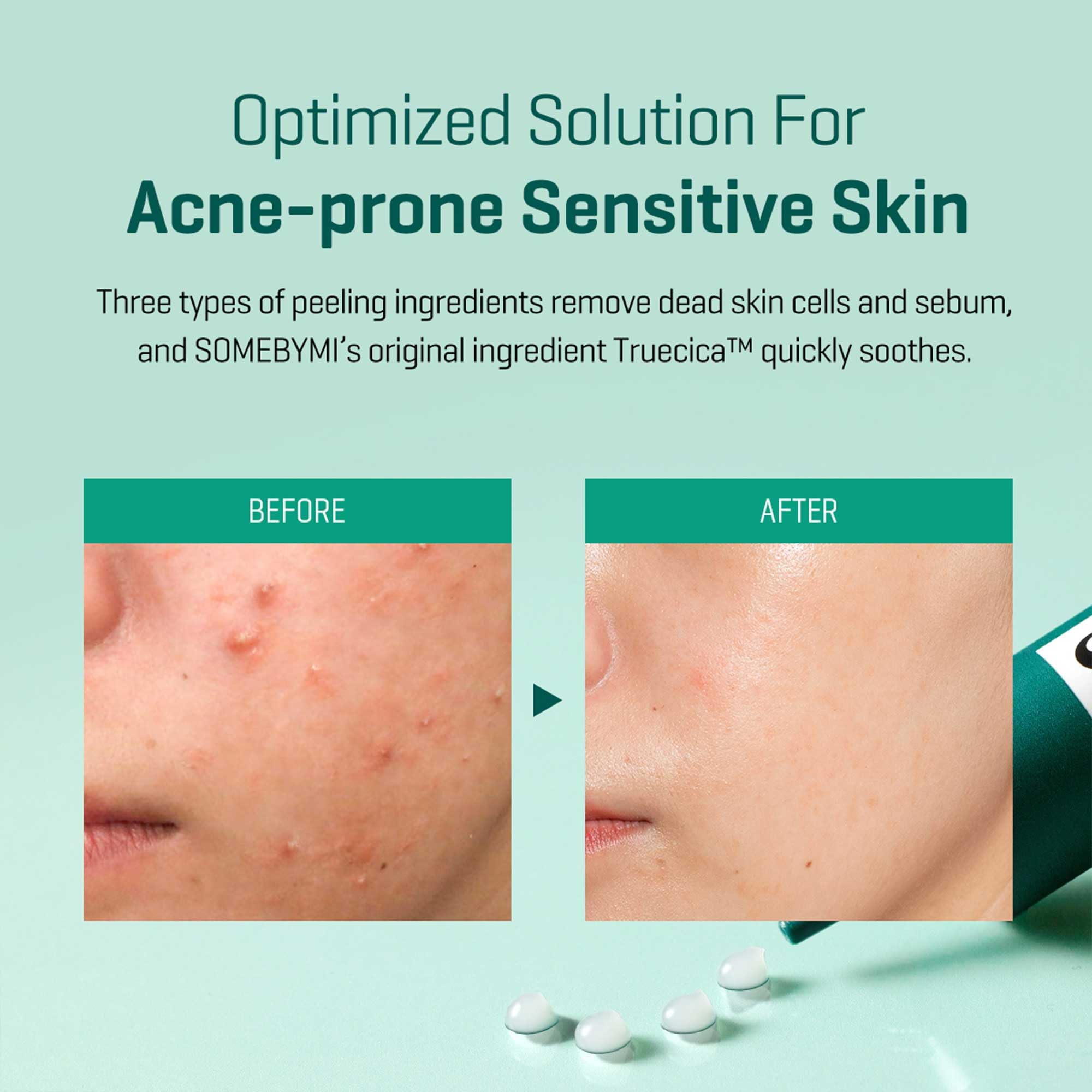 SOME BY MI hypoallergenic testing label on packaging emphasizes sensitive-skin compatibility.