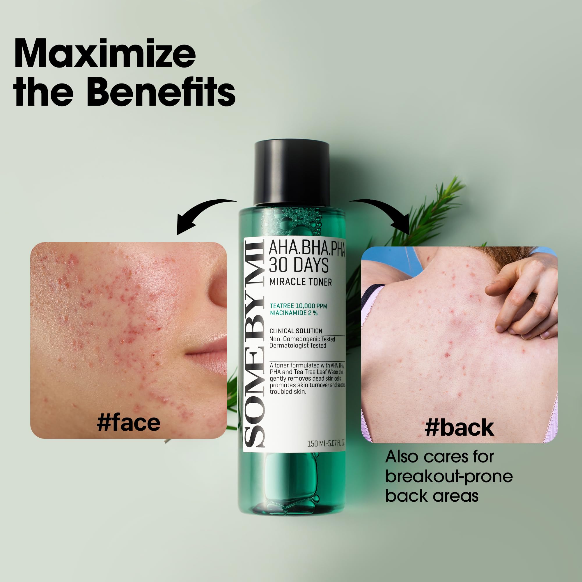 SOME BY MI Miracle Toner helps refine texture and brighten skin tone over time.