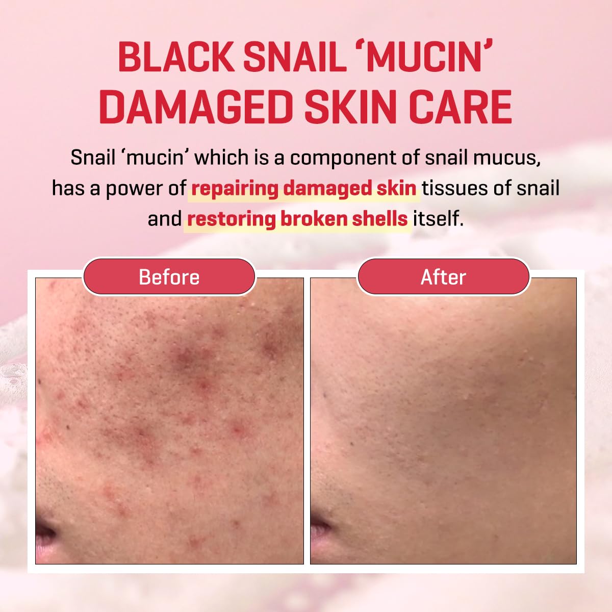 Hands applying SOME BY MI Snail Trucica Serum on skin