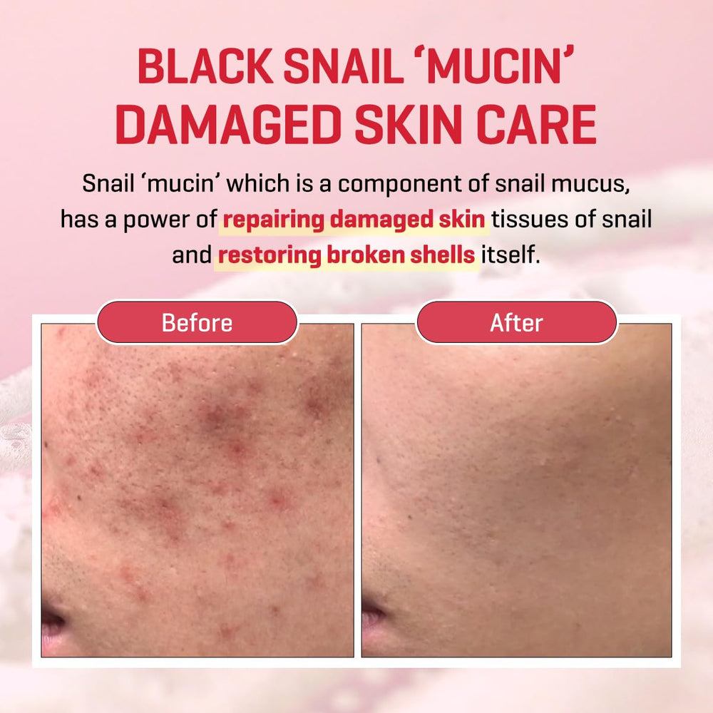 Hands applying SOME BY MI Snail Trucica Serum on skin