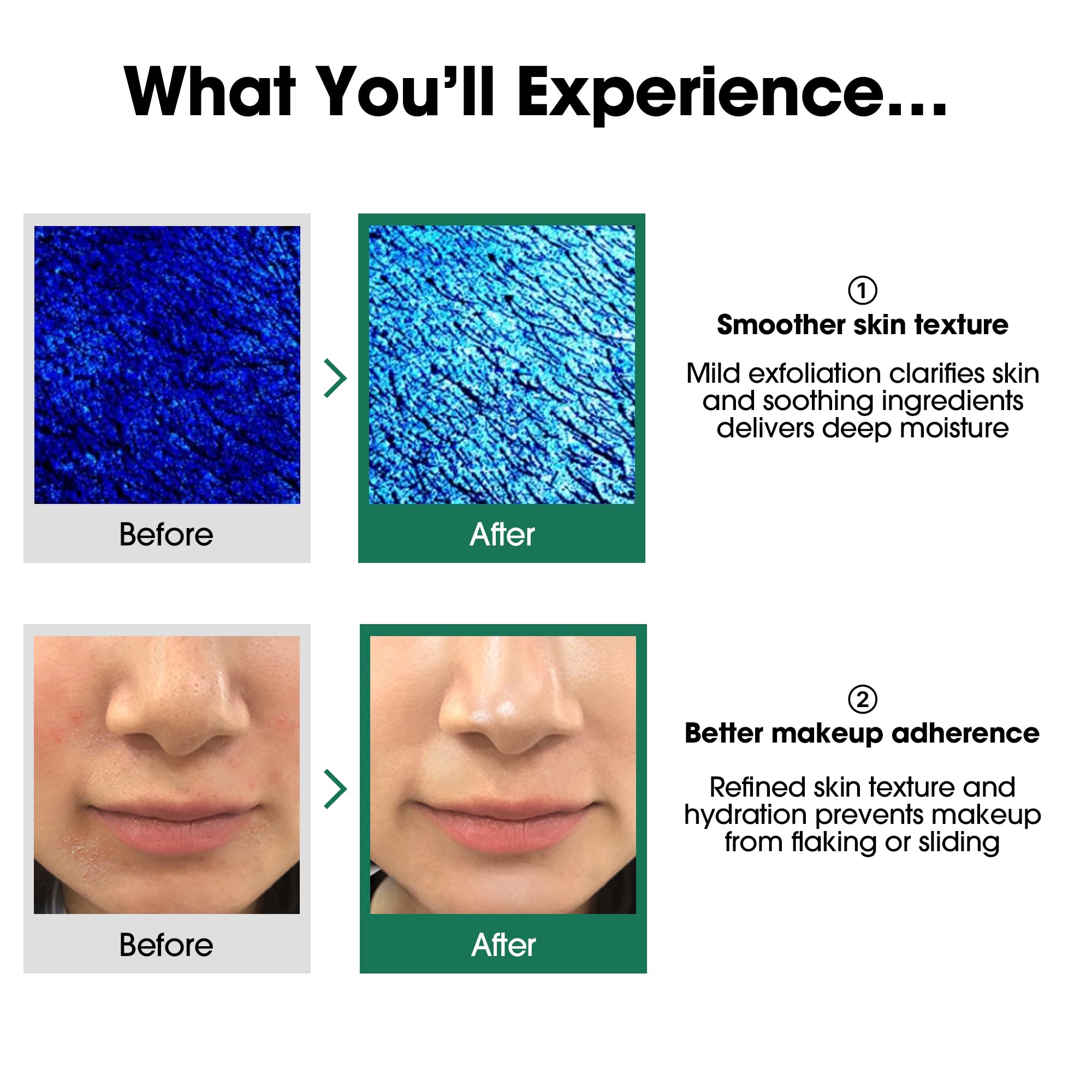 SOME BY MI Miracle Toner tea tree soothing extracts support calm pores during daily use.