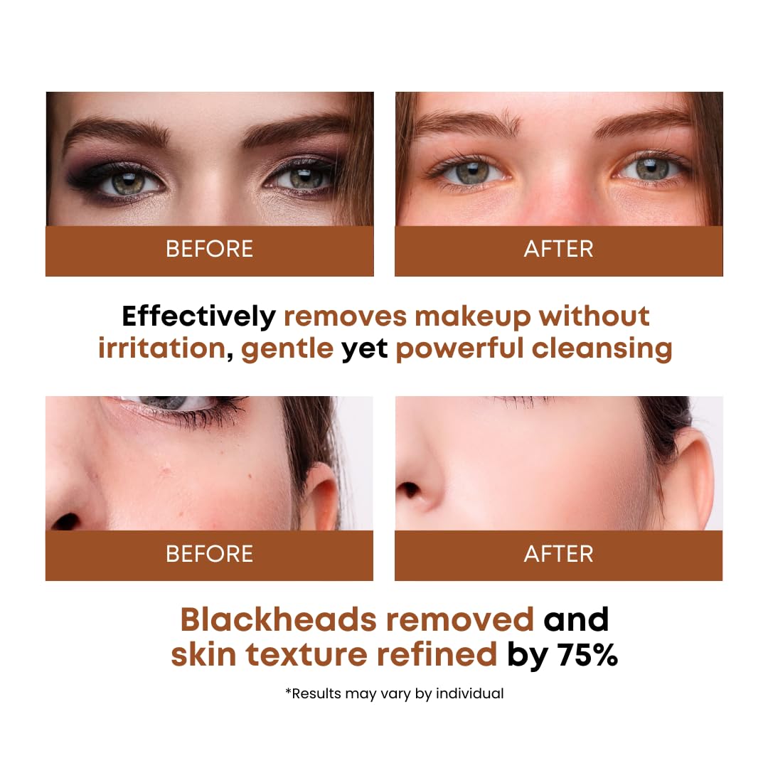 SOMISOME Oligo Hyaluronic Acid detail showing deep hydration and gentle cleansing