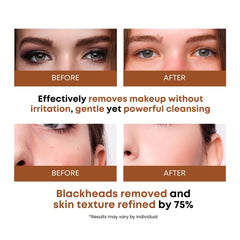 SOMISOME Oligo Hyaluronic Acid detail showing deep hydration and gentle cleansing