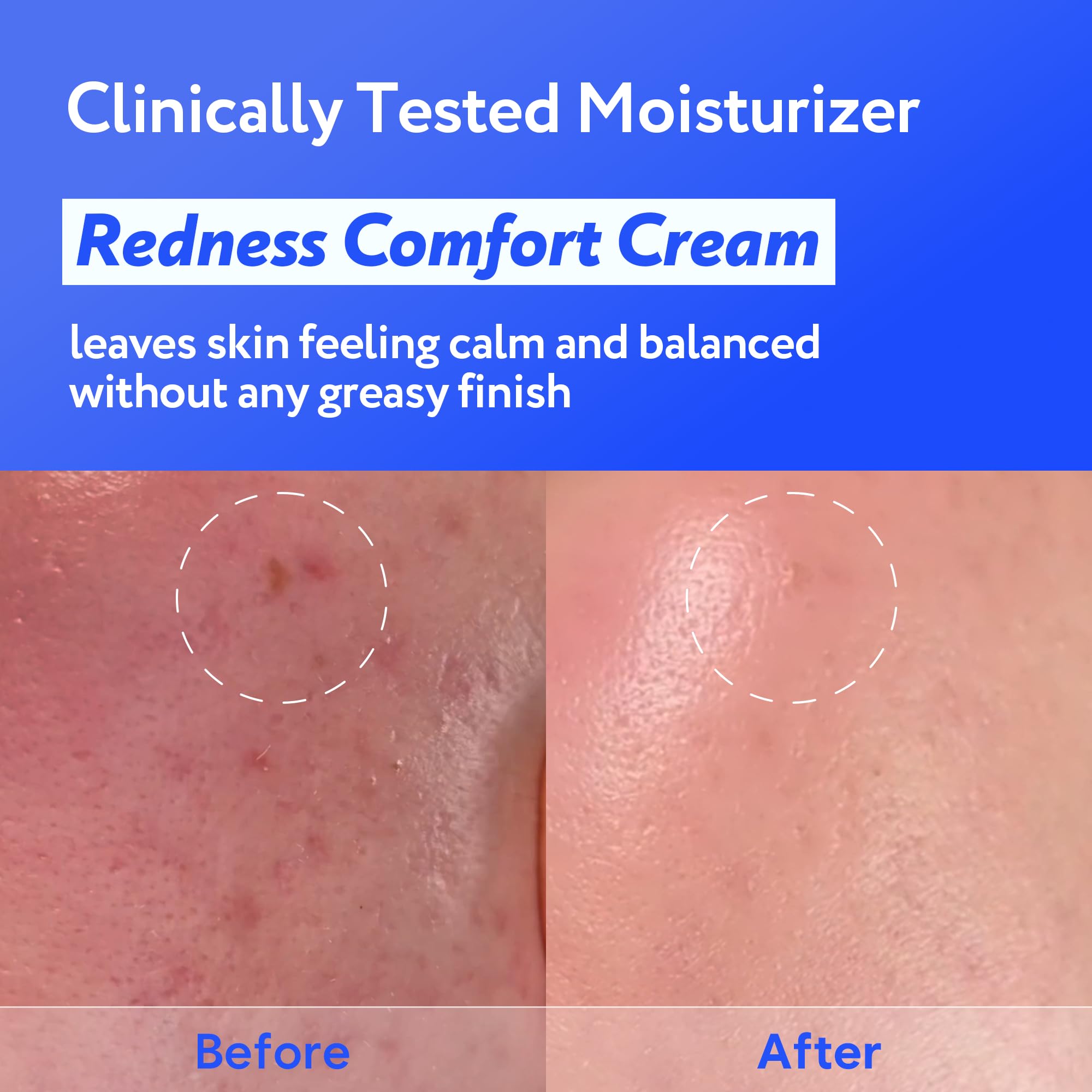 SOONDING Coconut Hydro Barrier Cream texture closeup demonstrates capsule-infused hydration that absorbs quickly.