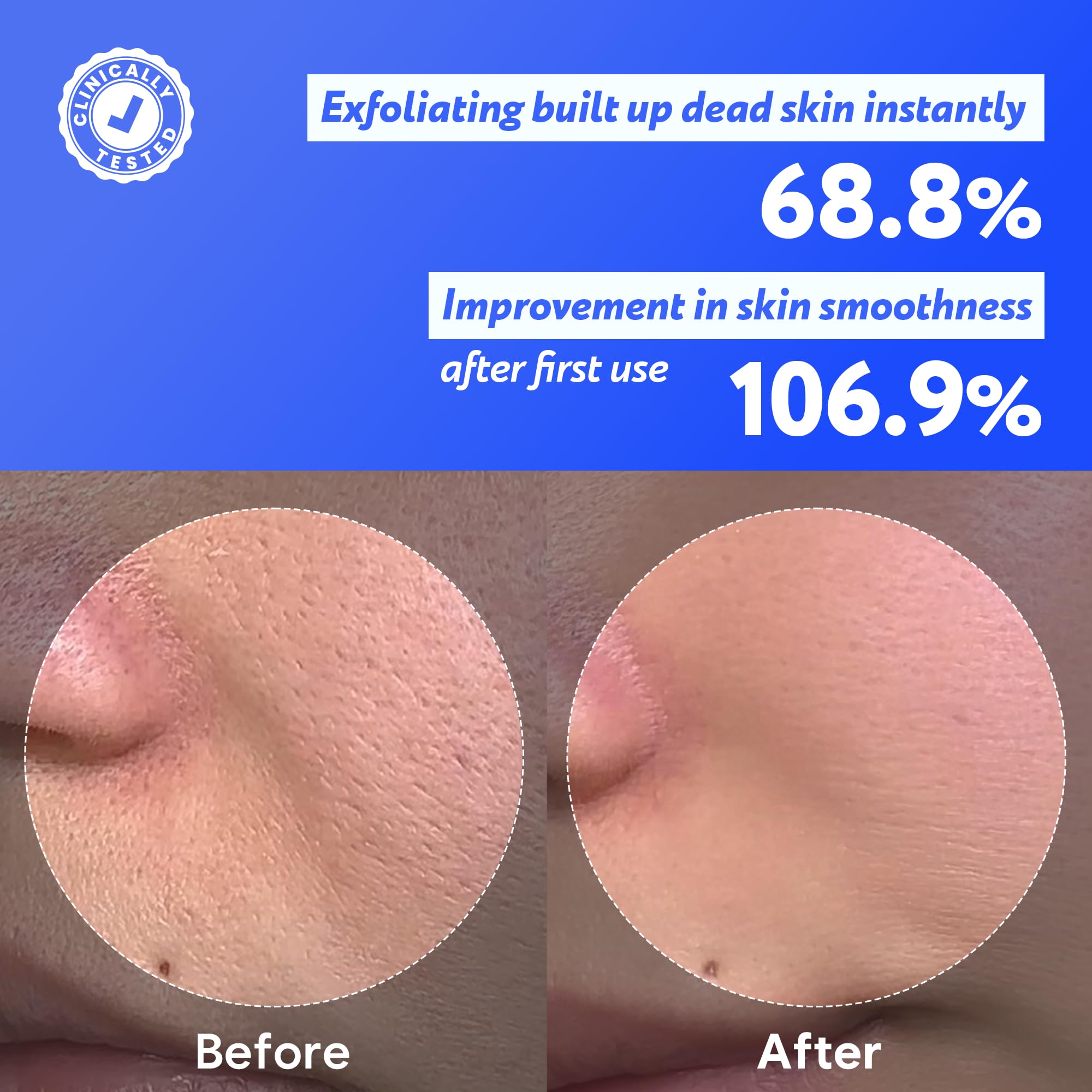 SOONDING Soft exfoliating beads close-up indicate mild polishing for smoother skin.