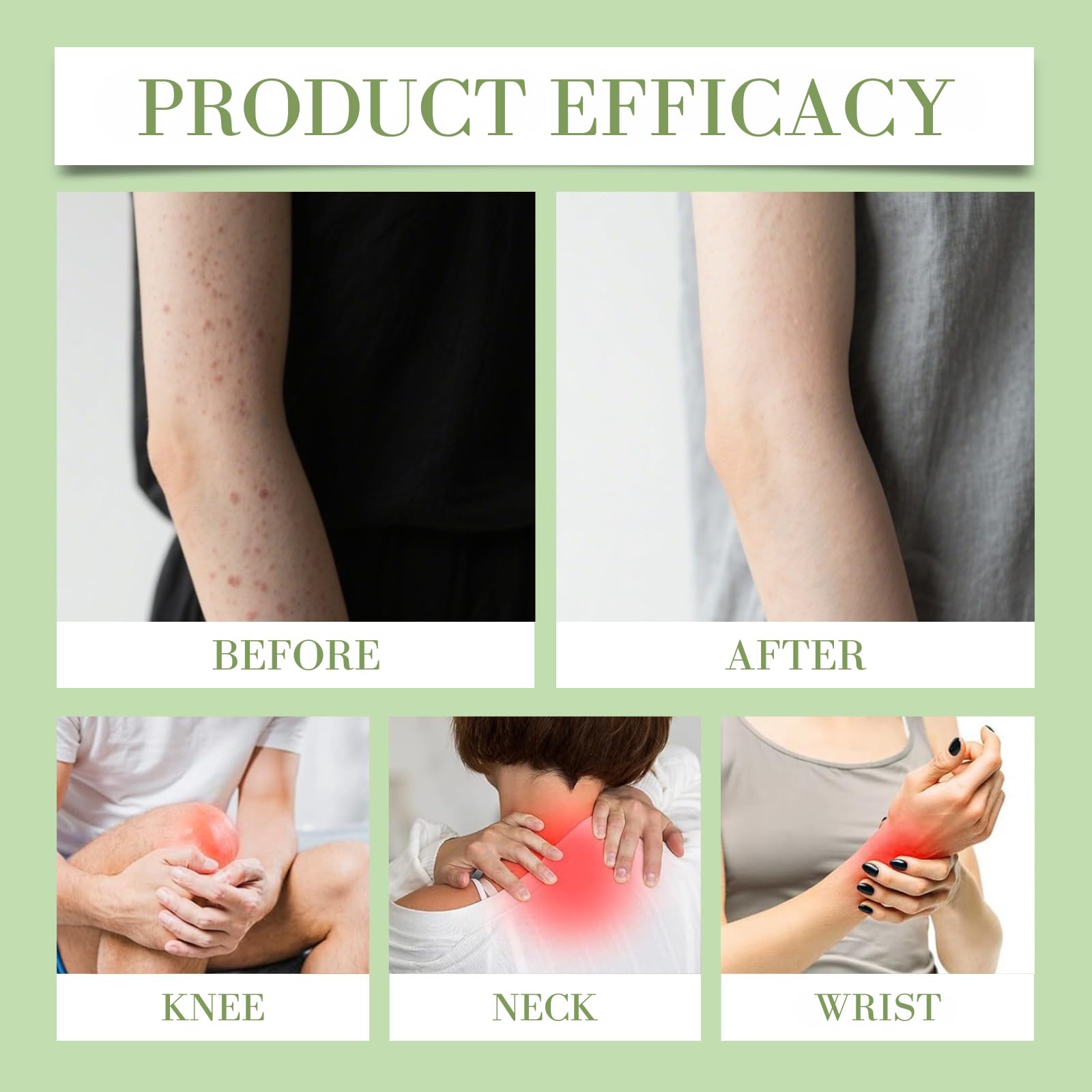 Soothing Relief Cream daily-use demonstrates non-irritating hydration for gentle skin routines.