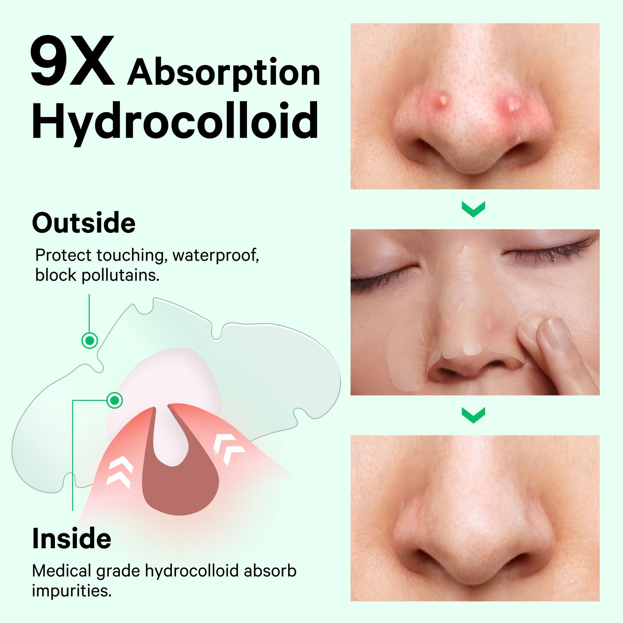 Sosky nose patches individually packaged for hygienic on-the-go use