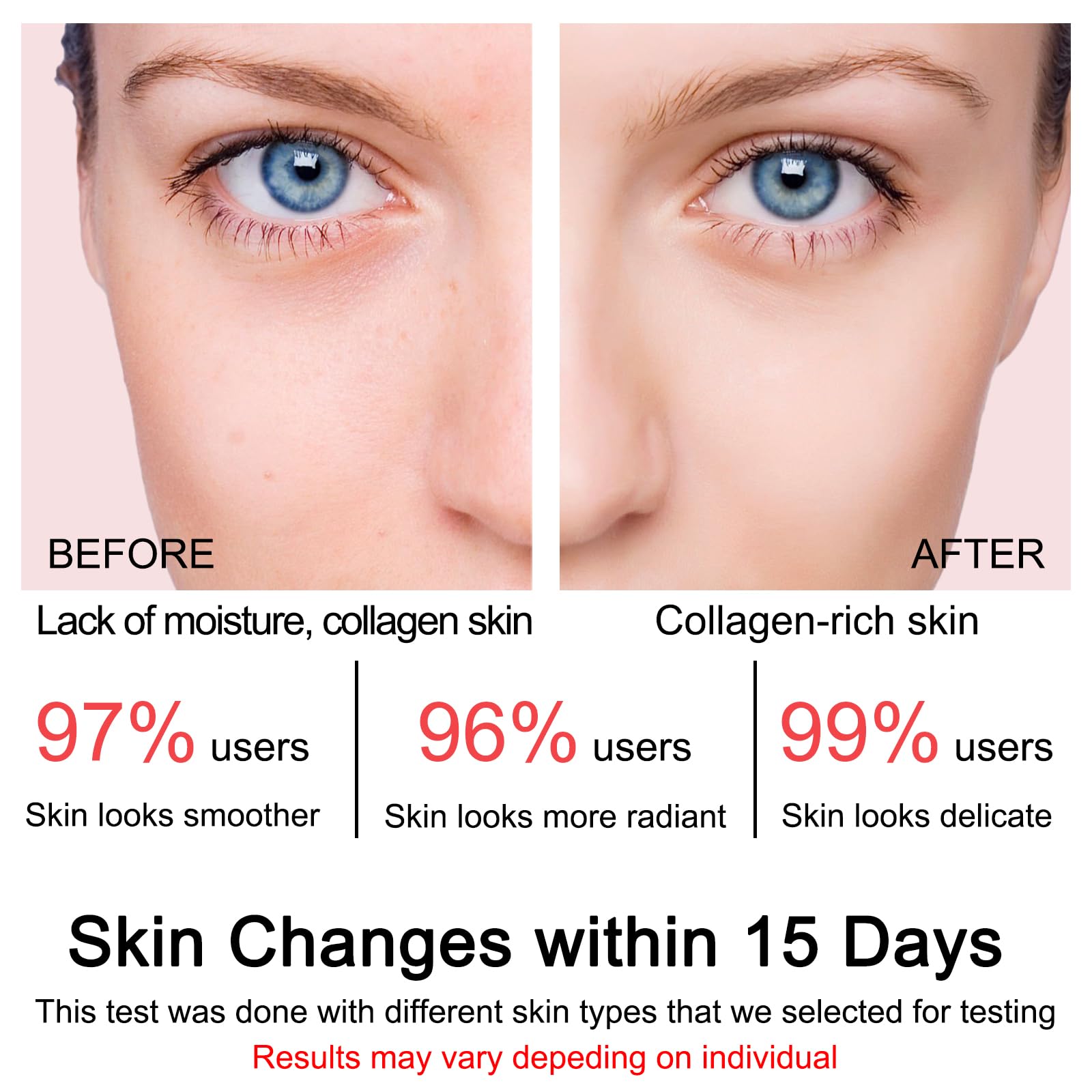 SOYUB Collagen Jelly Cream daytime use delivers refreshed skin with natural glow