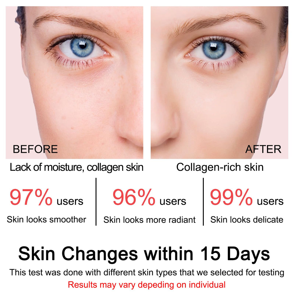 SOYUB Collagen Jelly Cream daytime use delivers refreshed skin with natural glow