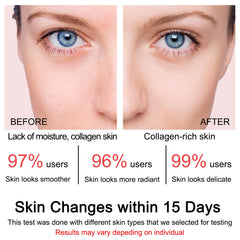 SOYUB Collagen Jelly Cream daytime use delivers refreshed skin with natural glow