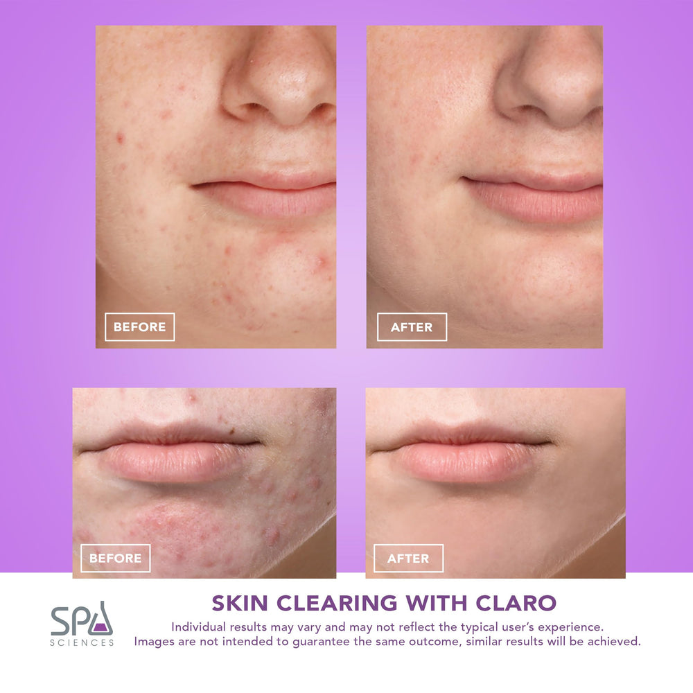 Spa Sciences CLARO warranty card emphasizes a two-year warranty for device confidence.